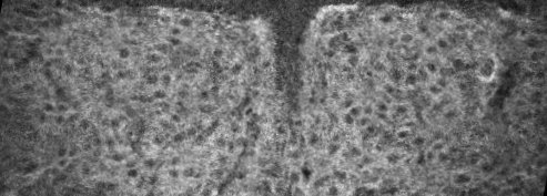 Immunofluroscence image of the XII nucleus